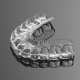 Invisalign