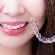 Invisalign® FAQs